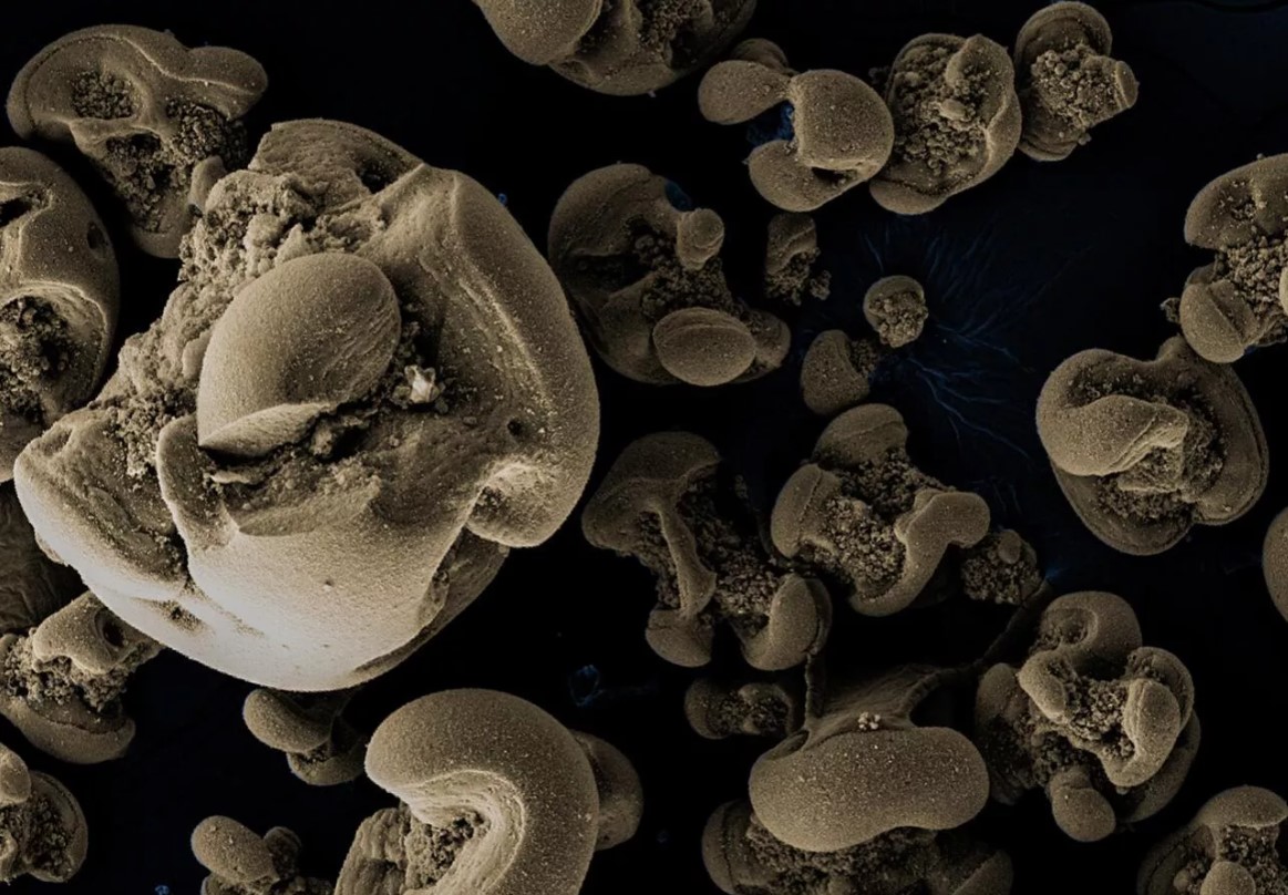 Обида микроскоп. Микробы. Рука под микроскопом. Марганцевые бактерии. Бактерии которые едят металл.